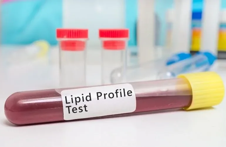 Lipid Clinic